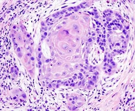 Histopathology & Cytopathology
