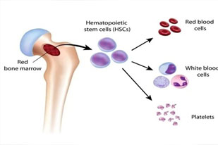 DISORDERS  OF HAEMOPOIESIS