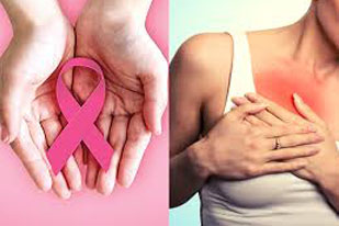 RISK SCREENING FOR FEMALE CANCER